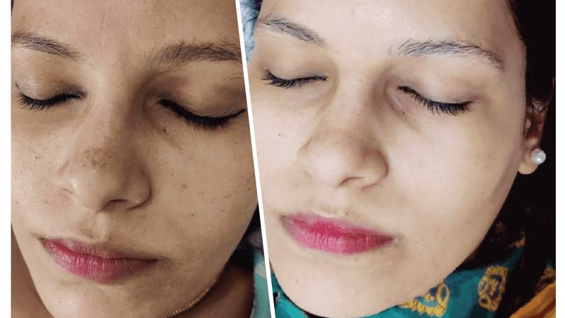 Skin Polish – Deep Cleansing & Glow Boost