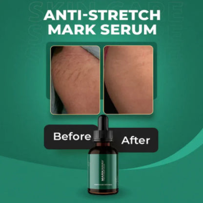 Markaway Stretch Mark Serum