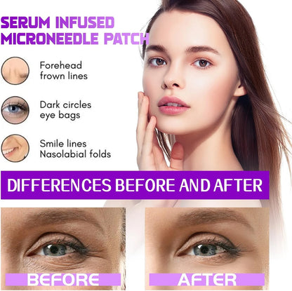 Botox Bee Venom Whitening & Tightening Cream