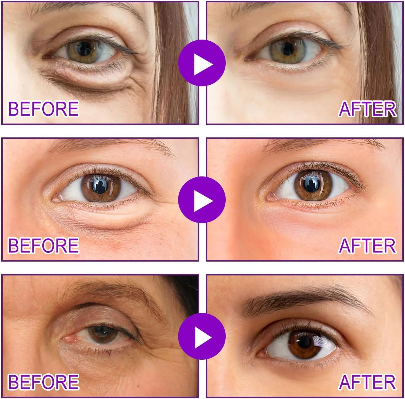 Botox Bee Venom Whitening & Tightening Cream