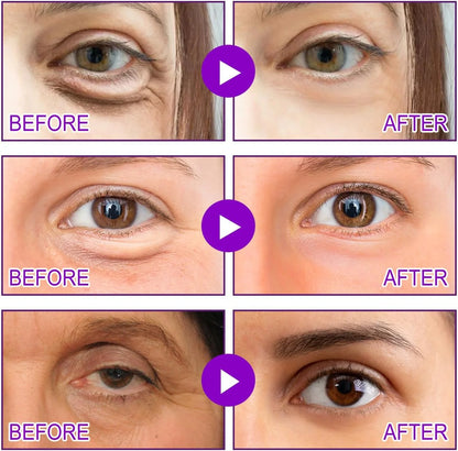 Botox Bee Venom Whitening & Tightening Cream