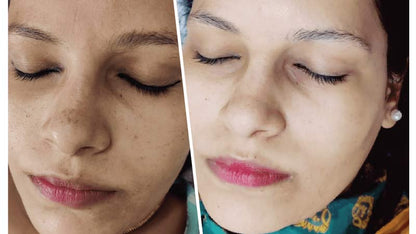 Skin Polish – Deep Cleansing & Glow Boost